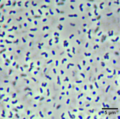 Caenimicrobium hargitense - mikroszkópos felvétel